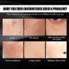 - Crema Correctora Para Marcas De Acné Y Defectos.