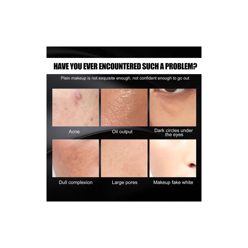 - Crema Correctora Para Marcas De Acné Y Defectos.
