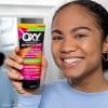 Oxy Acne Medication 10 Maximum Strength 148ml 5oz Importado