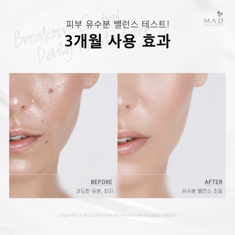 Mad Skin Care Sebum Cream Breakout Control Daily Moisturizer Cream