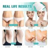 Crema Aclaradora Íntima Cuerpo Manchas Oscuras Tono Uniforme