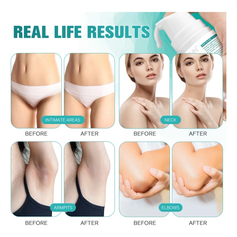 Crema Aclaradora Íntima Cuerpo Manchas Oscuras Tono Uniforme