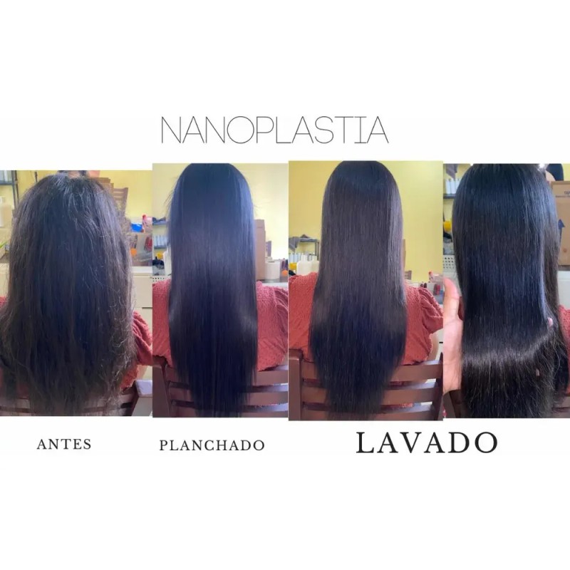 Alaciado Nanoplastia 1 L Kit
