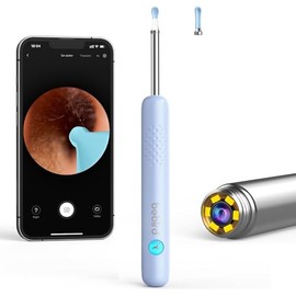 Bebird Pro Ear Wax Removal Tool with HD Camera and 6 LED Lights,Ear Cleaner for First Use and Smaller Ears Ear Camera and Wax Remover,for iOS,Android Phones