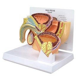 GPI Anatomicals - Human Anatomy Model of Male Pelvis with Benign Prostatic Hyperplasia (BPH), Replica for Anatomy, Physiology Education, Anatomy Model for Doctor's Office, Medical Learning Resources
