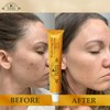 Organic Extract of Papaya Brightening Gel Tube | 30g |