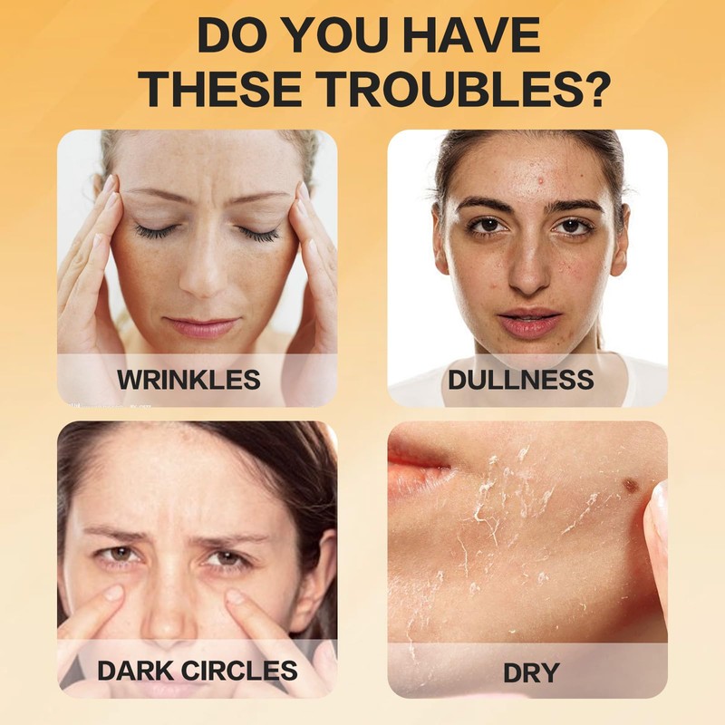 Landrain Pack of 100 Collagen Threads Lifting Set, Active Collagen