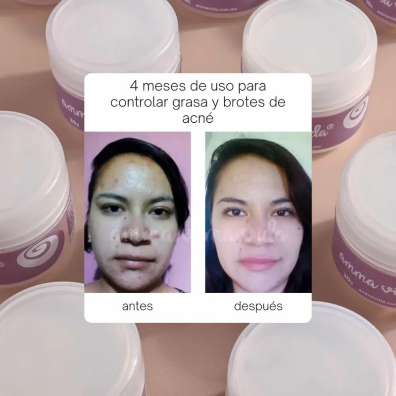 Crema Extra Nutrición Amma Vida, Nutre Tu Piel Y Humecta