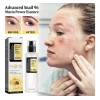 Ou Serum Escencia Caracol Avanzada Anti Arrugas Antiaging Momento De