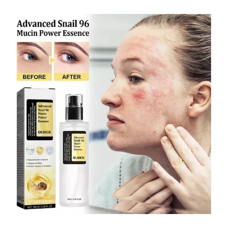 Ou Serum Escencia Caracol Avanzada Anti Arrugas Antiaging Momento De