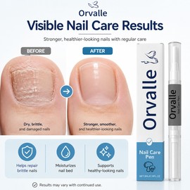 Nail Care Repair Pen for Brittle Nails – Moisturizing Strength Support for Daily Fingernail & Toenail Care