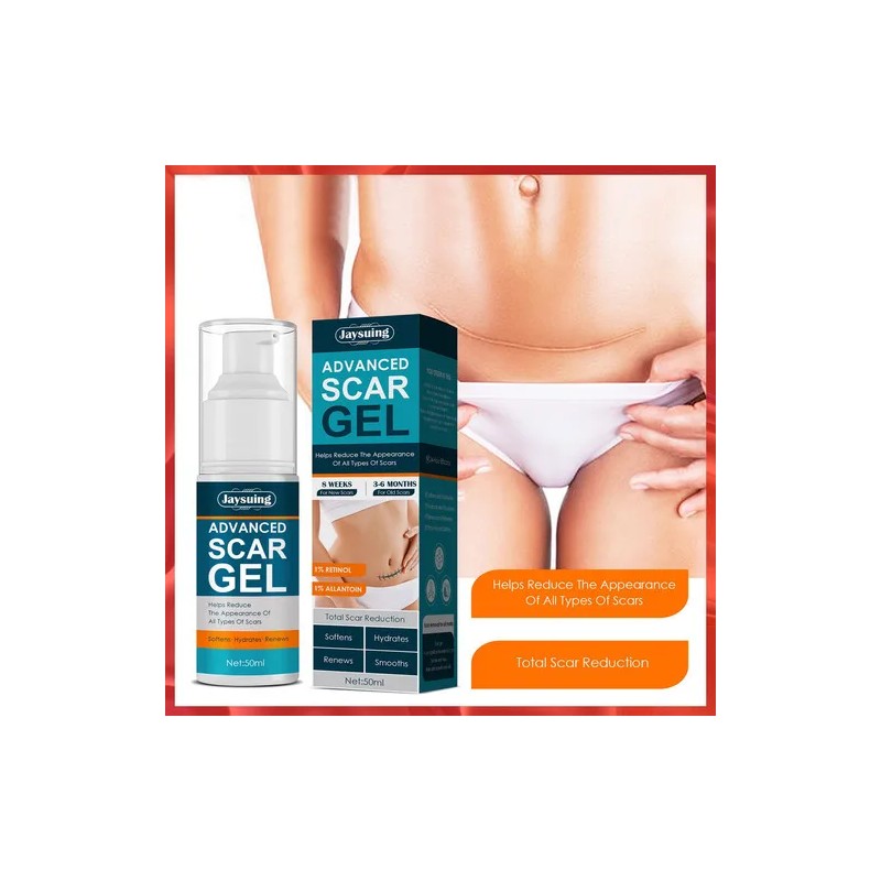Crema Para Cicatrices En Gel Queloid Acne Removal Treatment,