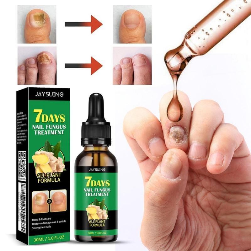 JAYSUING Ginger Nail Care Liquid, Nail Nutrients, Repairs Damaged and