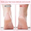 Electric Foot File and Callus Remover,Professional Pedicure Tools for Dry,