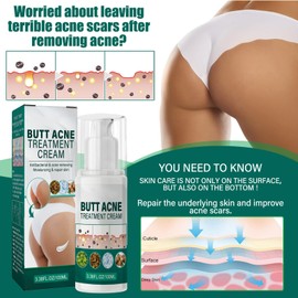 KOAHDE Buttock Whitening Pimples Treatment, Butt Pimple Whitening Treatment, Butt Pimples Cream 100ml