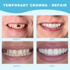 TTKBHHQ-Dental Temporary Crown Veneers Tooth Cap Crown Veneers,for Front Back