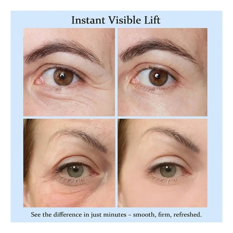 Wy Crema Tensora Para Las Bolsas Debajo De Los Ojos,
