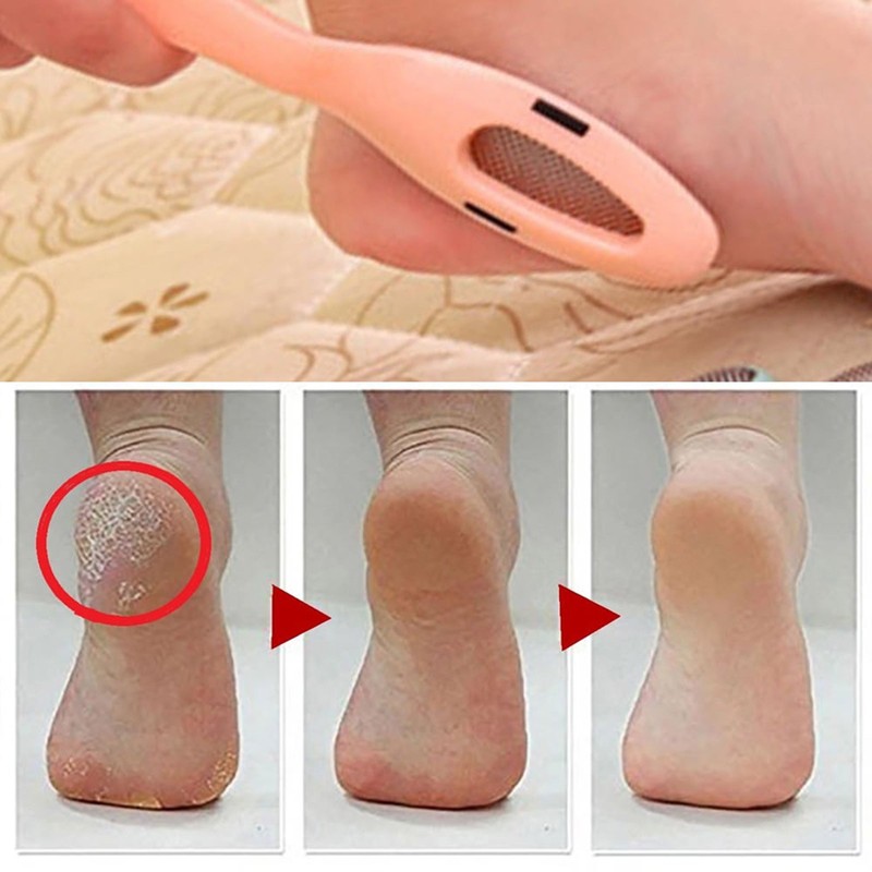 Glamza Pedicure File Callus Remover