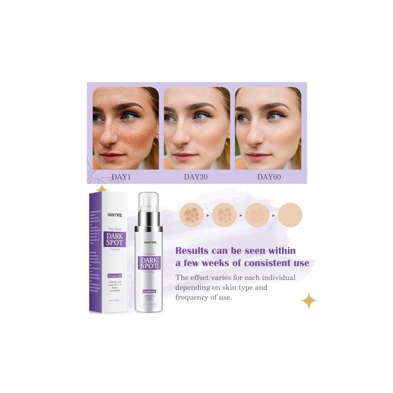 Crema correctora de manchas oscuras para rostro y cuerpo, crema