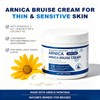 Arnica Bruise Cream for Thin Sensitive Skin on Arms &
