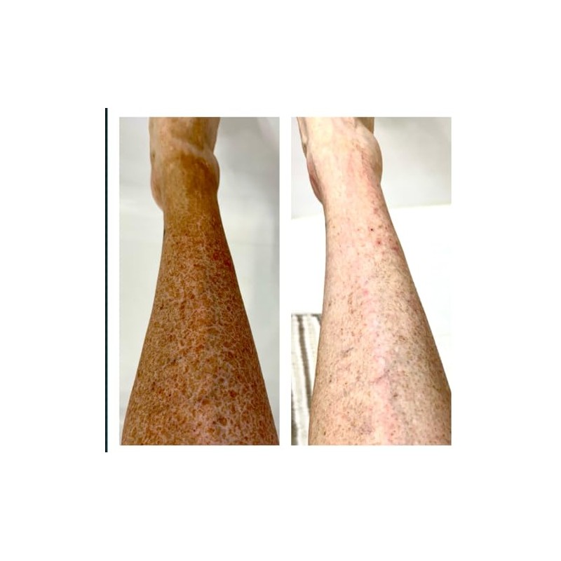 Tan Alchemy Clean Slate Sunless Tan Remover, 4 oz, 60-Second