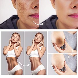 FAMIROSA- Corrector de manchas oscuras en la zona íntima: crema para axilas, rodillas, codos y cara interna de los muslos, Private Par