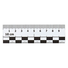 Smileyboard Photo Scale Magnet - 10cm Car Magnet for Damage Identification - Ideal for Experts & Appraisers