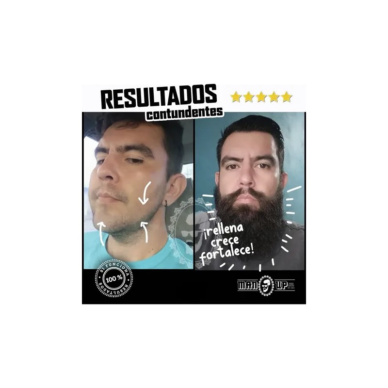 Tópico Para Crecimiento De Barba Y Cabello. Formula Clasica
