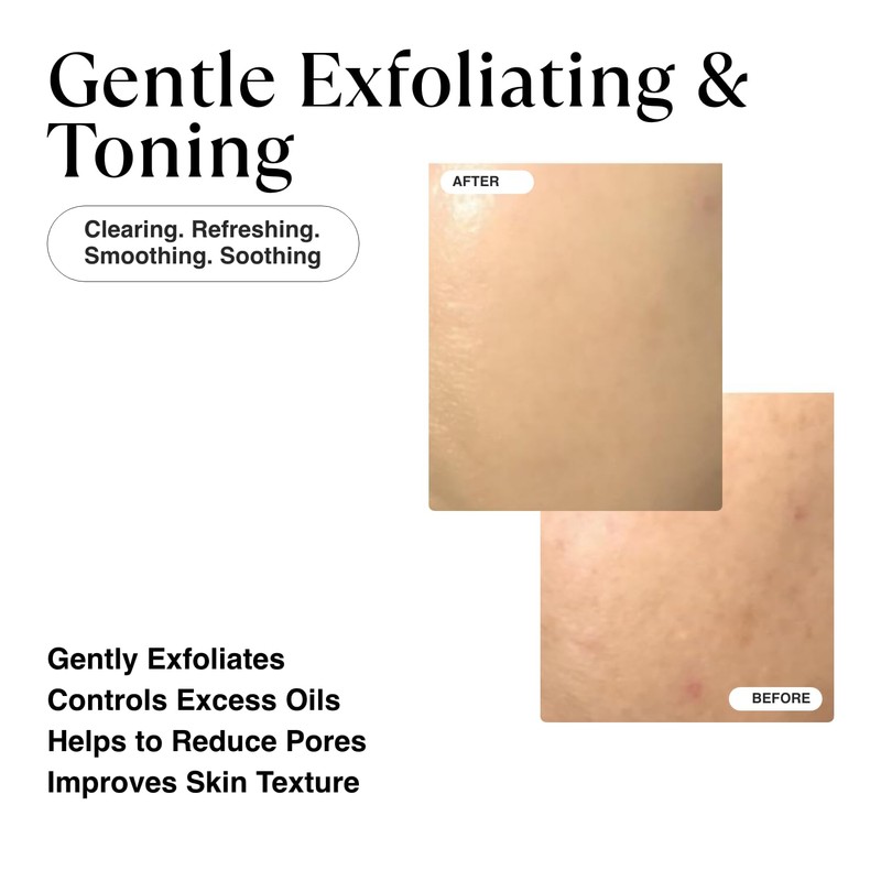 MATKAS Korean Exfoliating Toner Pads with Witch Hazel - 60