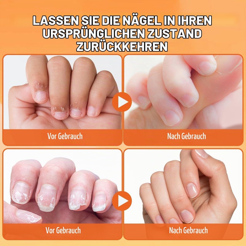 Pack of 2 anti-fingernails chewing, anti-nail chewing, bitter nail pen