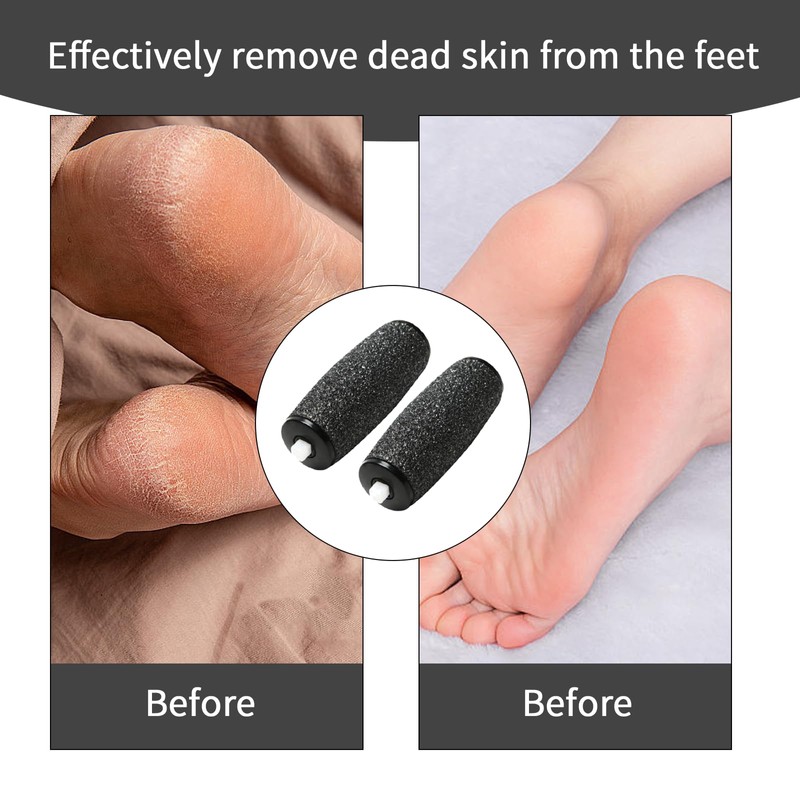 12 Pcs Foot File Replacement Rollers, Extra Coarse Refill Rollers