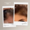 Kit 4 Tónicos Vittale Anticaída Crecimiento Cabello Paso 1