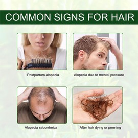 Organic Castor Oil Cold Pressed,100% Pure, Hair Growth Oil Hair Serum Scalp Oil For Eyebrows,Eyelashes,Hair Growth,Nails,And Skin,Hair Care Hair Loss Treatment For Women And Men