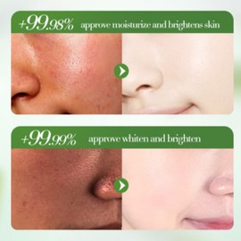 Eazerom 22 Aloe Vera Gesichtscreme, 50g Reine Aloe Vera Hydratisierende Erfrischende Feuchtigkeitscreme, Aloe Vera Gel Gesichtscreme, Anti-Falten und Nährend, Glättende Feuchtigkeitslotion