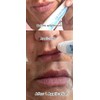 Diva Stuff- Suero para líneas de labios, máxima potencia, con