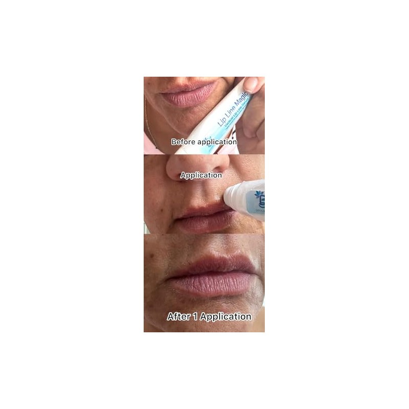 Diva Stuff- Suero para líneas de labios, máxima potencia, con