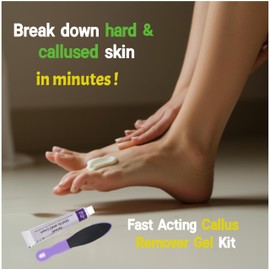 Sarsvati Fast Acting Callus Remover Gel Kit,Corn Remover for Feet, Hard Skin Removal, Corn Removers for Toes Feet, Exfoliating Foot File Pedicure Tool Included