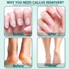 Electric Foot Callus Remover for Feet,15 Speed Adjustable Pedicure Tools