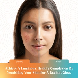 GoodBeauty 20% Vitamin C Face Serum, Aloe Vera Facial Serum with Hyaluronic Acid, Aloe Vera, Vitamin C Serum For Face - Made in Canada - 30 mL