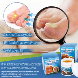 Endogene Zehennagelpflege, Zehennagel-Reparaturcreme, Nagelpflege Creme, Repariert Zehennägel, Stärkt Zehennägel, Fördert gesundes Zehennagelwachstum, Professionelle Fußpflegecreme (20 g)