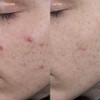 BYOMA Blemish Clearing Paste with Cica and Salicylic Acid |