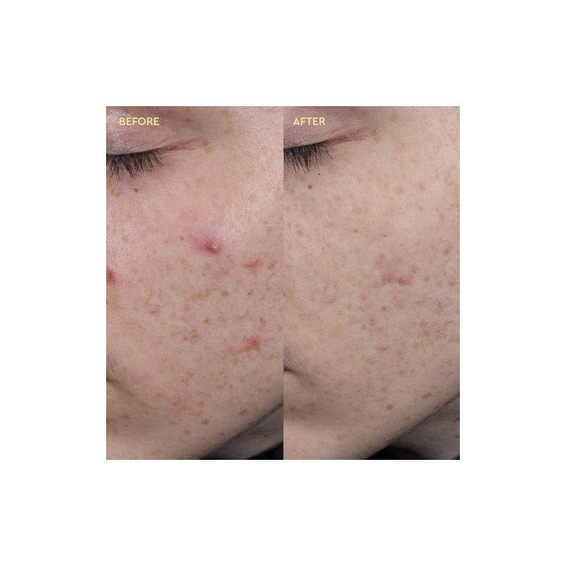 BYOMA Blemish Clearing Paste with Cica and Salicylic Acid |