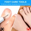 EIH1 Ingrown Toenail Set, Stainless Steel, Nail Corrector, Nail Tool,