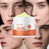 Acne Cream Multi-Acid Deep Relief – 4% Lactic Acid BHA/AHA
