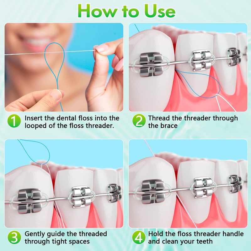 Floss Threaders, Orthodontic Threader, Ultraclean Access Tool for Maintaining Oral