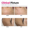 The Lapo R Ampoule 50ml Wrinkle Regeneration Anti-Aging The Lapo