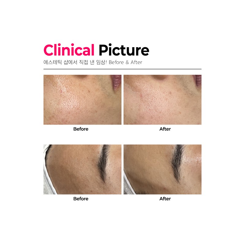 The Lapo R Ampoule 50ml Wrinkle Regeneration Anti-Aging The Lapo