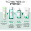 Skin1004 Madagascar Centella Tea Trica Piel Bha Acne 4 Kit