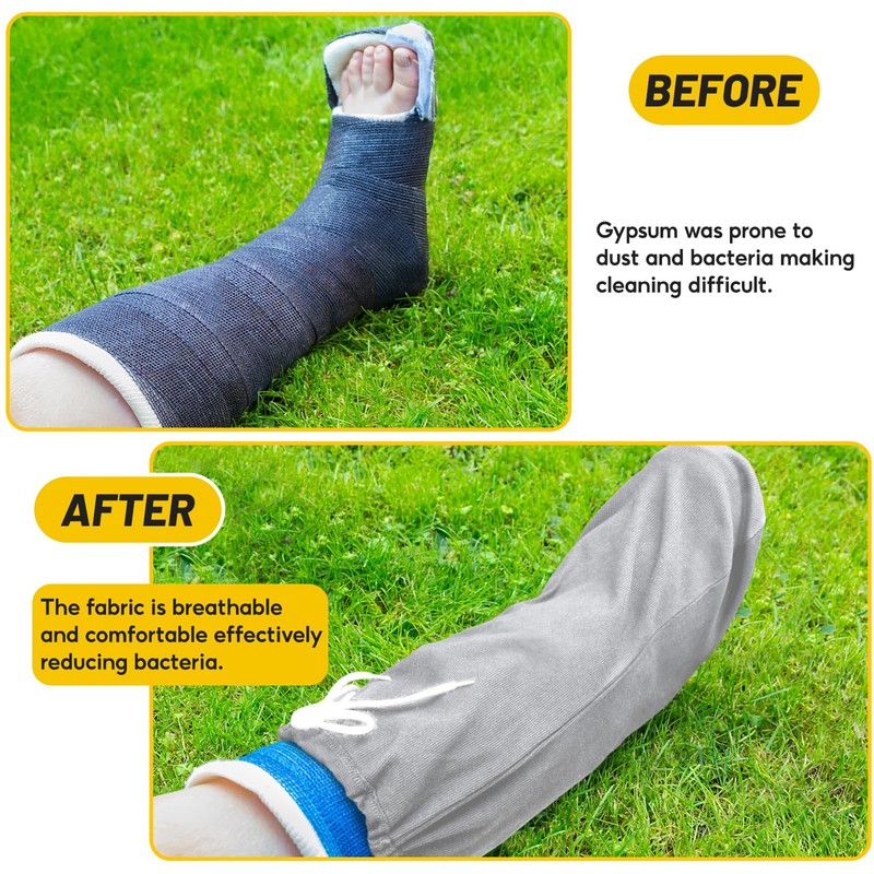 Max Shape Washable Leg Cast Cover, Adjustable Knee Sock for