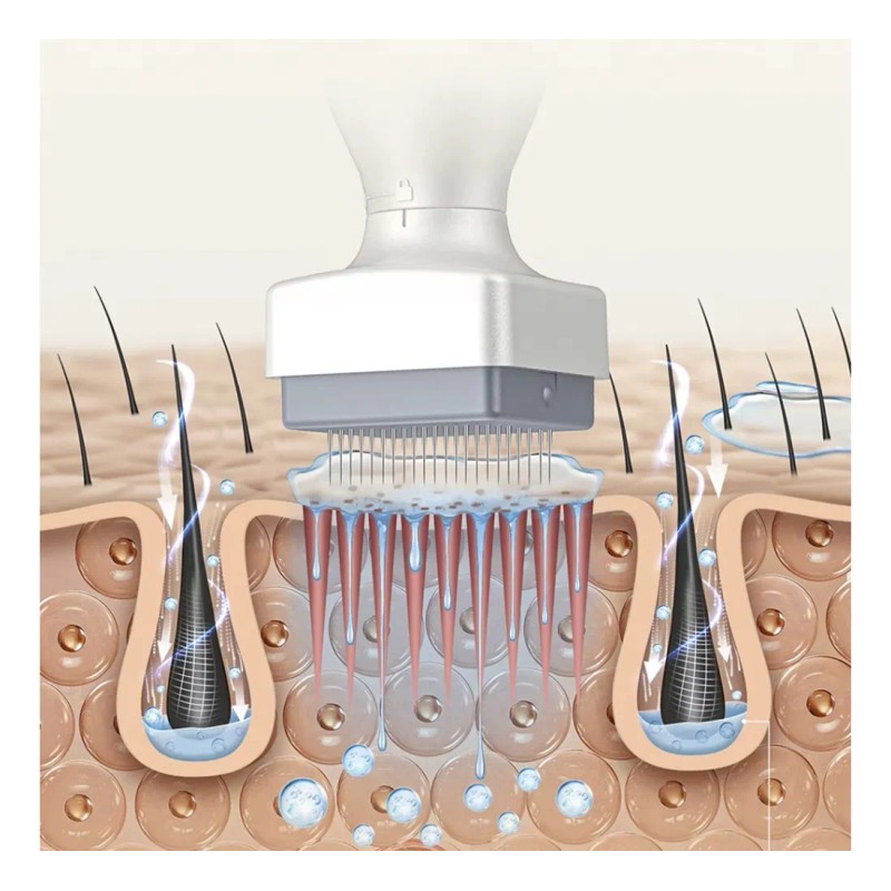Barbarian Brothers Dermastamp 120 + 64 Microagujas Ajustables Dermaroller